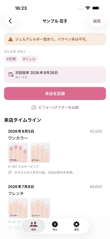 顧客の詳細。ジェルアレルギー・パラベン不可の注意を上部に出し、次回目安の日付と、来店タイムラインがデザイン写真と金額つきで続く